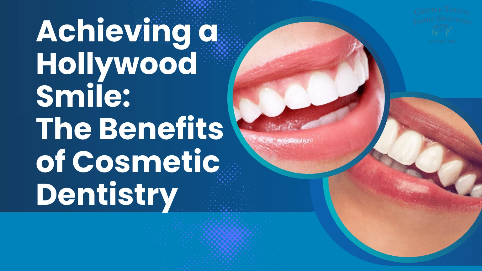 Achieving a Hollywood Smile: The Benefits of Cosmetic Dentistry