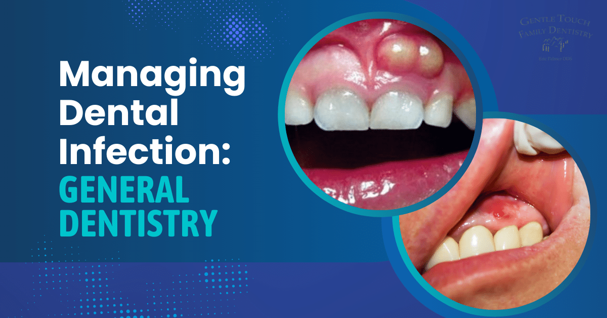Managing Dental Infection General Dentistry