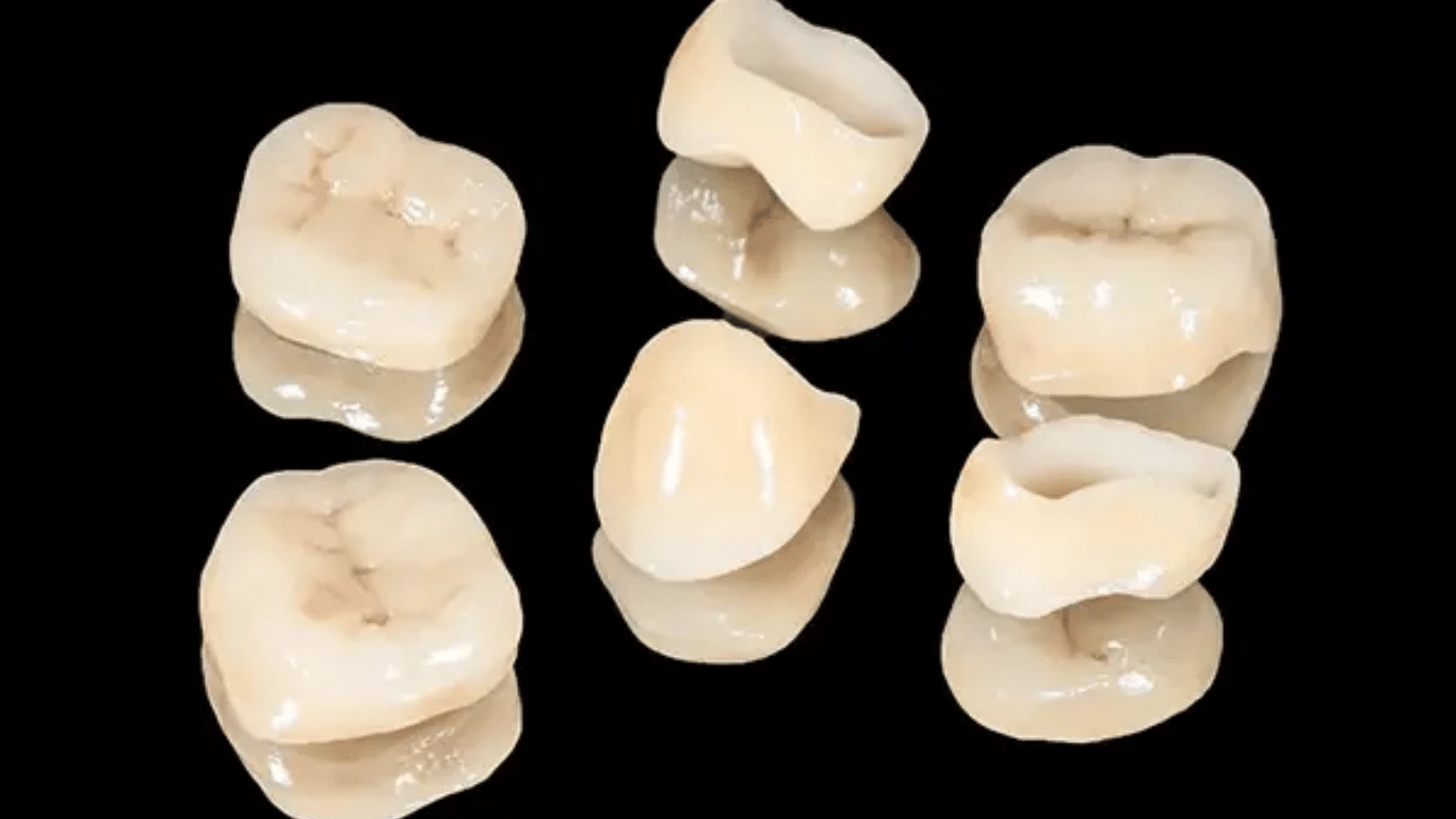 Perfect Teeth Dental Crowns in Tooele UT for Your Ideal Smile