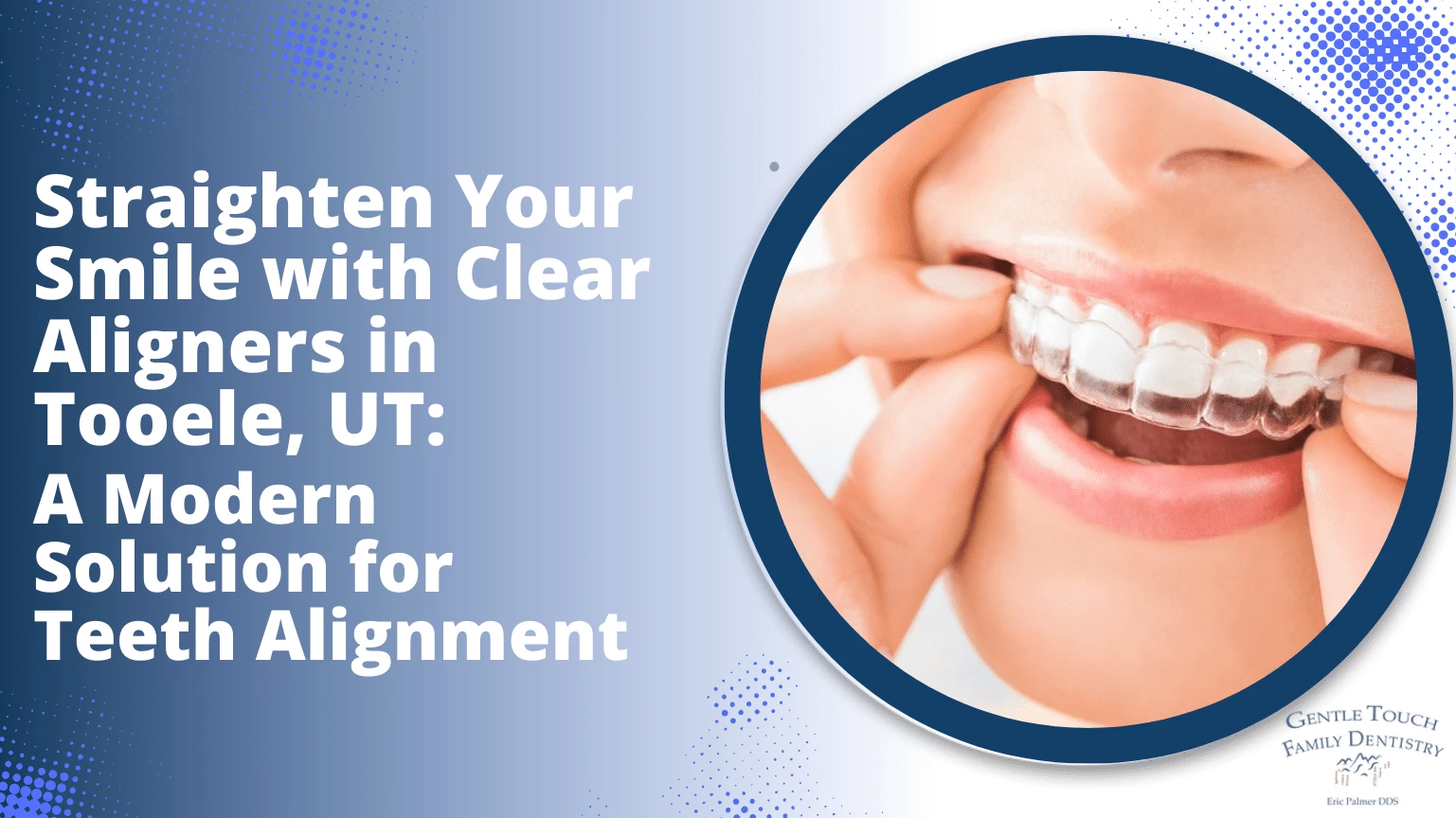 Straighten Your Smile with Clear Aligners in Tooele, UT A Modern Solution for Teeth Alignment