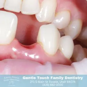 Why Gentle Touch Family Dentistry is Your Go-To for Dental Emergencies