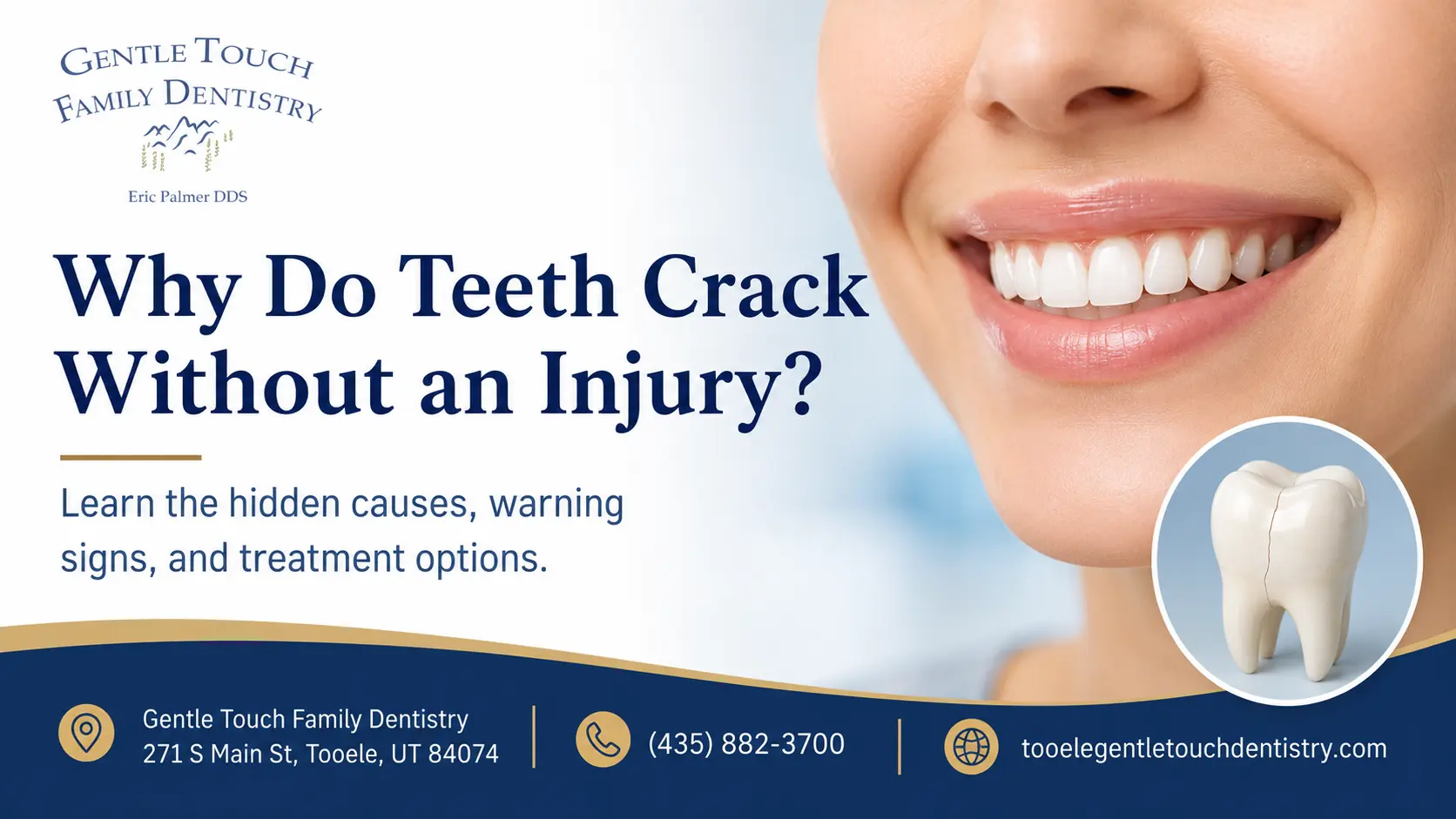 Why Do Teeth Crack Without an Injury?